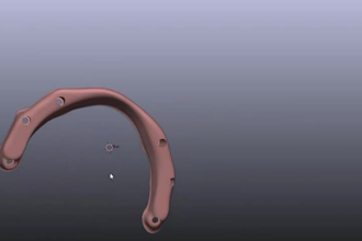 design dental restorations in exocad