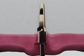 do 3d dental animation medical dental procedure animation with clinical accuracy