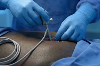 ai medical animation, medical explainer for patient education, healthcare video