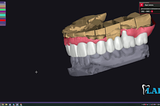 provide professional exocad dental design and 3d modeling services