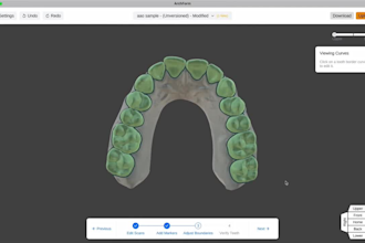 custom aligner treatment plans with 3d clincheck