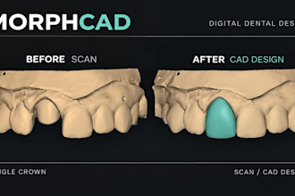 design dental crowns bridges and implants in exocad