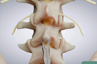 create 3d medical animation video, surgical animation, spine surgery procedure