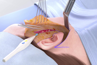 create realistic and cgi 3d medical animation for surgery procedures