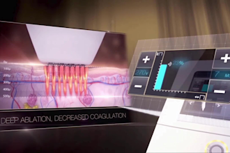 create 3d medical animation medical device animation and mechanism action video