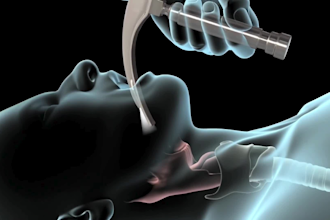 do 3d medical animation surgery anatomy animation 3d scientific animation video