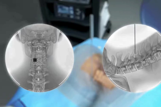 create surgical animation medical animation 3d medical animation device