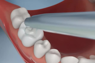do 3d medical animation 3d surgery animation anatomy animation 3d medical video
