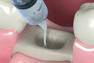 create a 3d clear aligner and orthodontic teeth straightening  animation