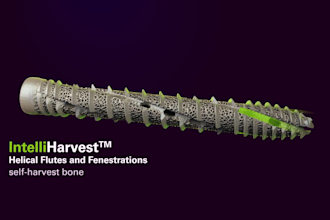 create 3d medical animation, surgery explainer video, medical device bio medical