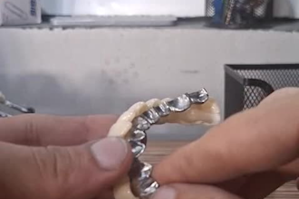 design custom dental implant ibar in blender for dental