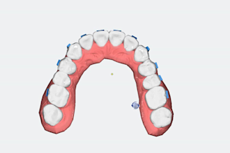 provide professional digital orthodontic treatment planning for clear aligners