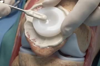 create 3d medical animations and medical explainer  video