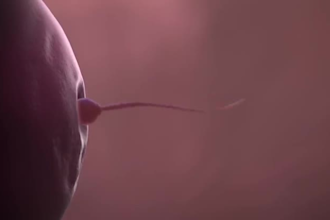 create 3d medical animation, surgery explainer video, industrial medical device