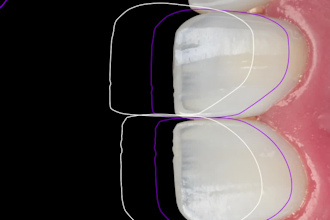 create premium dental motion graphics and social media reels