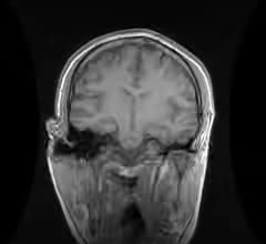 provide expert ct mri cbct radiology reports by telemed image