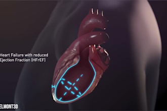 create accurate 3d cardiovascular surgery and heart anatomy animations