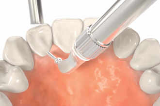 do 3d dental animation, 3d dentistry process, 3d medical animation