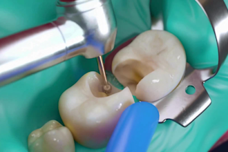 do 3d dental animation 3d dental surgery animation 3d dental implant animation