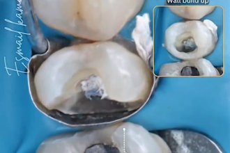 high quality dental motion graphics to elevate your marketing