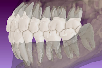do dental cbct dicom segmentation and stl conversion