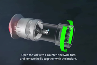 do 3d dental implant process animation dental device explainer and medical video