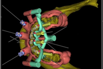 deliver expert surgical guide design and digital dental restorations