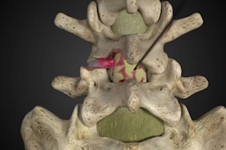 create 3d medical surgery dental healthcare equipment product animation video