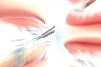 do medical animation, surgery, dental, bone fracture dislocation explainer video