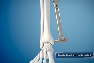 create 3d medical device animation for healthcare products
