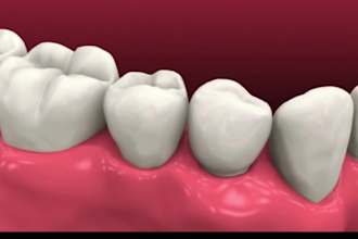 provide dental implant procedure planning and full mouth implants workflow