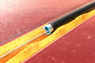 do 3d medical device, catheter, vascular explainer and surgical device animation