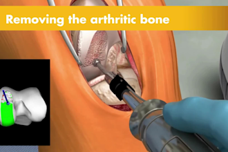 do 3d medical animation video 3d anatomy surgery explainer video medical device