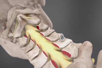 realistic 3d medical and healthcare animations