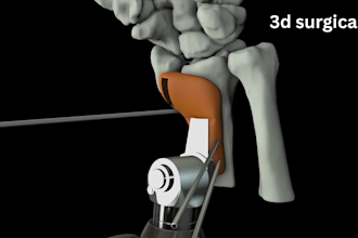 create 3d medical animation, surgical animation, surgery animation video