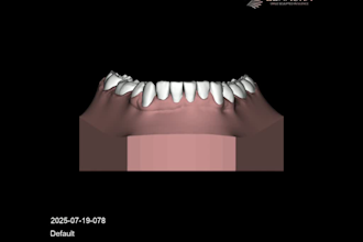 expert clear aligner treatment planning by orthodontist and lab owner