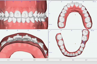 do orthodontic treatment planning and clear aligner setups