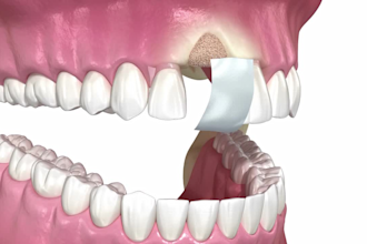 3d dental animation videos for medical explainer and dentist marketing