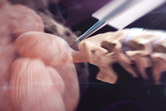 do 3d medical animation, 3d dental implant procedure video orthodontic animation