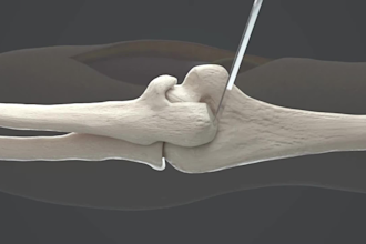 create 4k medical animation for surgery procedure or product demo