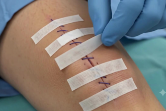 ai powered medical device video, 3d ai medical animation surgical video