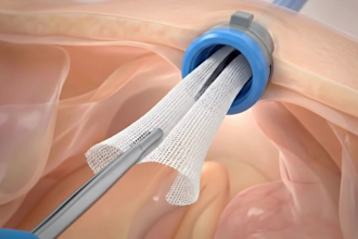 create 3d medical animation, product animation and medical explainer video