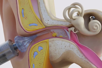 create 3d medical animation anatomy videos pharmaceutical surgical procedure