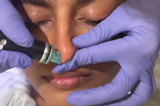 edit before and after videos for medical spas and aesthetic clinics
