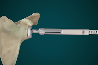 create 3d orthopedic surgery animation bone and joint animation 3d animation