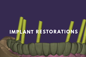 provide professional dental cad design using exocad