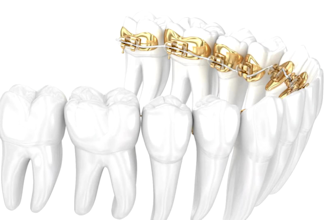 do 3d dental animation invisalign orthodontic and dental treatment video