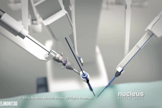 animate minimally invasive laparoscopic and robotic surgical procedures in 3d
