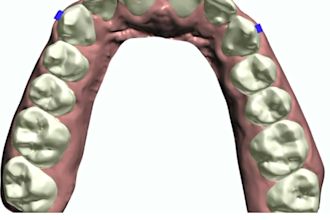 do dental clear aligner treatment planning on archformh and 3shape
