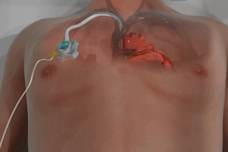 create 3d cardiovascular medical device animation and medical explainer video